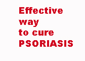 Treatment of psoriasis