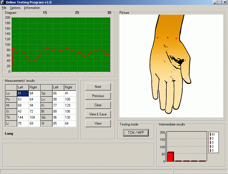 Ryodoraku Online Testing Program v1.0