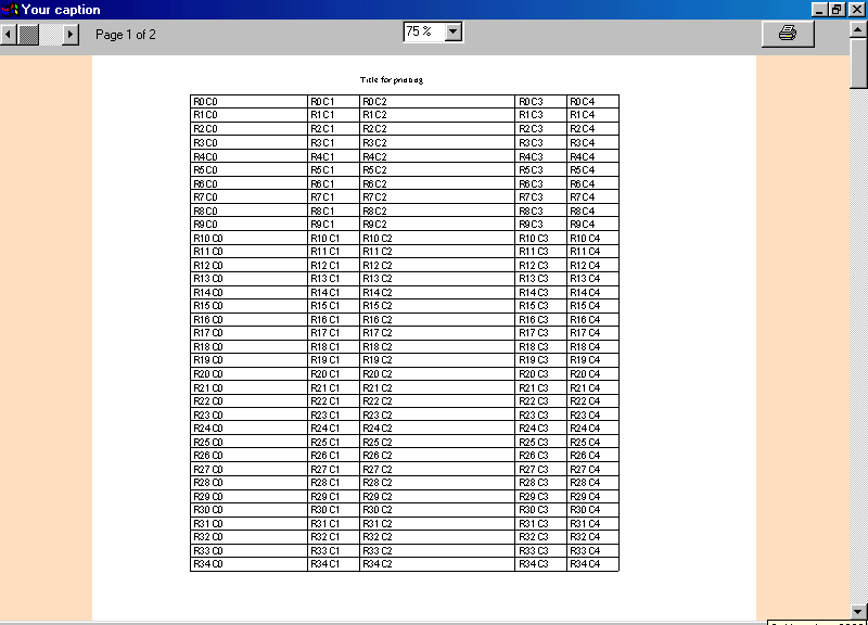 SCML MSFLEXGRID PRINTER